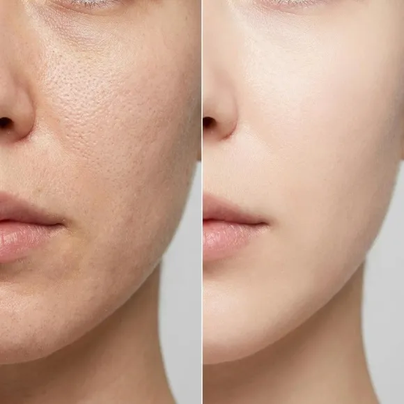 Омолаживающая альгинатная маска с коллагеном MEDIPEEL Collagen Vegan Red Lacto Modeling Cup Pack MEDIPEEL Collagen Vegan Red Lacto Modeling Cup Pack 5